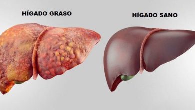 Photo of Hígado graso puede derivar en cirrosis o cáncer