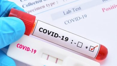 Photo of Salud Pública reporta 151 casos nuevos de Covid