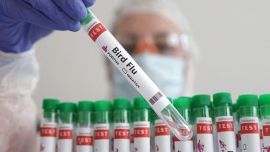 Photo of EEUU reporta la primera muerte por gripe aviar en el país