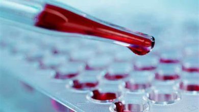 Photo of Un ensayo prueba la utilidad de un biomarcador en sangre para diagnosticar el alzhéimer